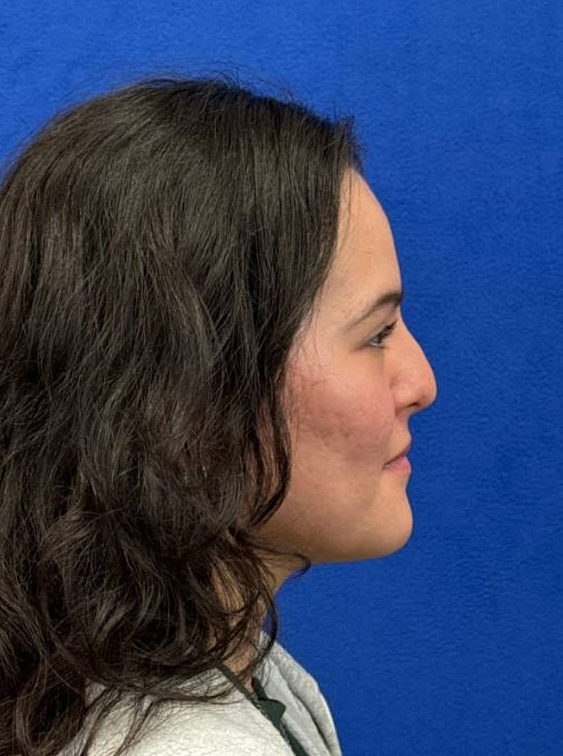 Profile view of a woman against blue background.