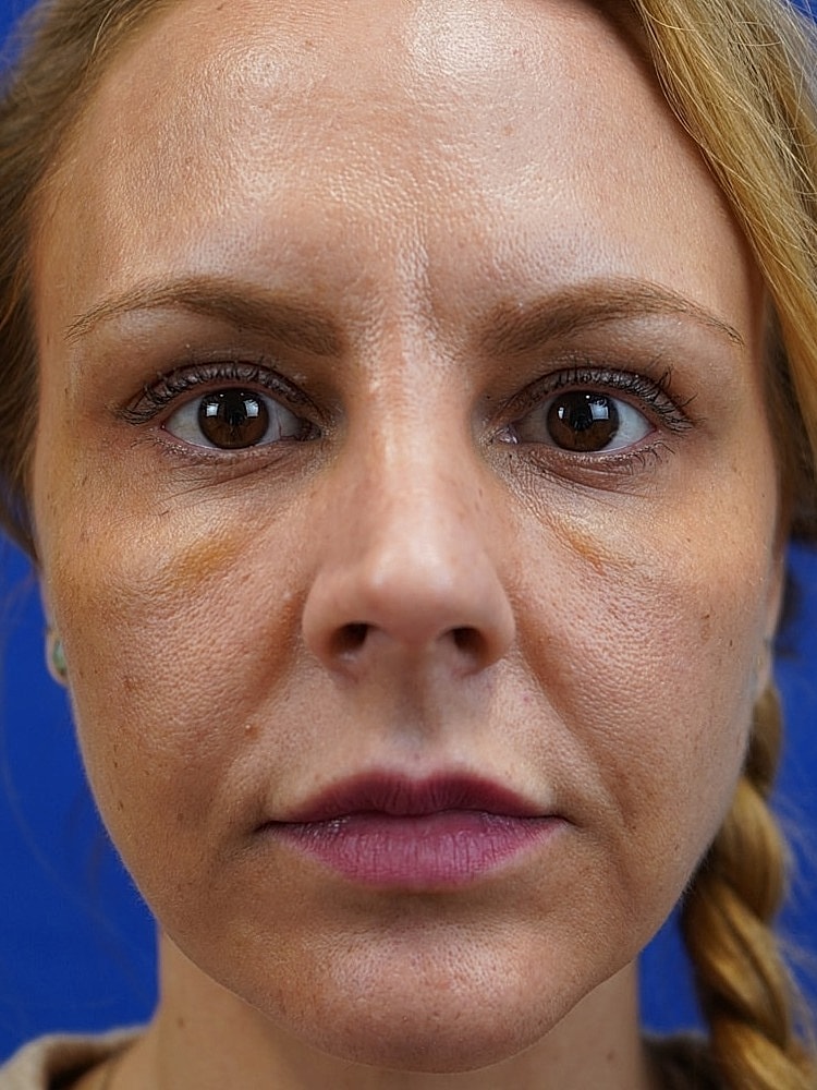 Woman's close-up portrait with natural expression.