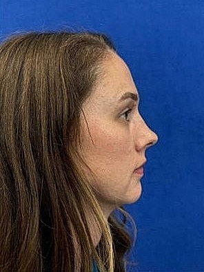 Profile view of a woman with long hair.