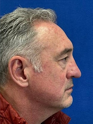 Side profile of a man with gray hair.