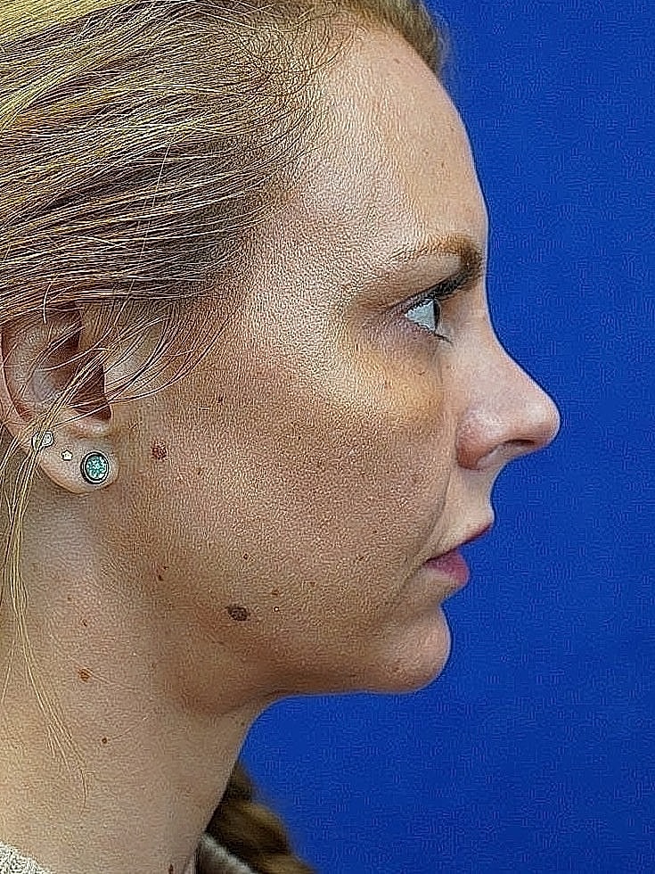 Profile view of a woman against a blue background.