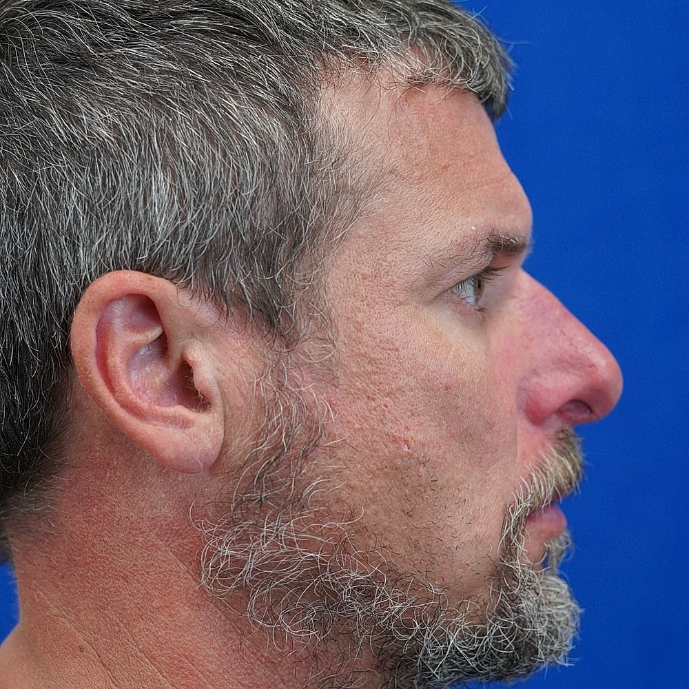 Profile of a man with gray hair and beard.