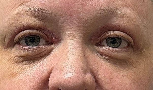 Close-up of a person's eyes and face.